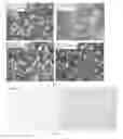 Fig. 02 - AN ALUMINUM ALLOY AND THE PREPARATION PROCESS THEREOF