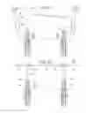 Fig. 16 - Shock absorbing retractable bollard systems