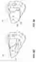 Fig. 08 - Methods and systems for detecting heavy machine wear