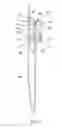 Fig. 07 - Cordless curtain assembly with magnetic units