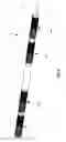 Fig. 05 - Device for lining or obturating a wellbore or a pipe