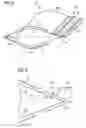 Fig. 03 - Rotor blade with noise reduction means
