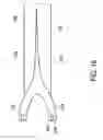 Fig. 15 - Wind turbine rotor blade with a rotor blade connection and method for producing same