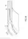 Fig. 16 - Wind turbine rotor blade with a rotor blade connection and method for producing same