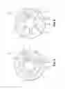 Fig. 04 - Turbine engine stator vane, fan casing comprising such a vane, thrust reverser system of a turbine engine equipped with such a vane and turbine engine equipped with said vane, said casing or said system