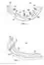Fig. 03 - Methods for shimming flexible bodies