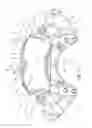 Fig. 11 - Disc brake and brake pad set