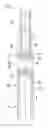 Fig. 05 - Bicycle chain and motion transmission system comprising such a chain