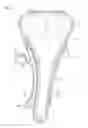 Fig. 08 - Chain tensioner
