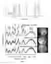 Fig. 05 - RAMAN SPECTROSCOPY SYSTEM, APPARATUS, AND METHOD FOR ANALYZING, CHARACTERIZING, AND/OR DIAGNOSING A TYPE OR NATURE OF A SAMPLE OR A TISSUE SUCH AS AN ABNORMAL GROWTH
