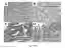 Fig. 09 - RAMAN SPECTROSCOPY SYSTEM, APPARATUS, AND METHOD FOR ANALYZING, CHARACTERIZING, AND/OR DIAGNOSING A TYPE OR NATURE OF A SAMPLE OR A TISSUE SUCH AS AN ABNORMAL GROWTH