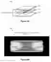 Fig. 05 - ELECTRODE DRIVE AND SENSING CIRCUITS AND METHODS
