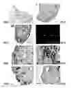 Fig. 09 - METHOD FOR DIAGNOSIS OF INFLAMMATORY DISEASES USING CALGRANULIN C