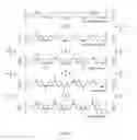 Fig. 02 - METHOD FOR DETECTING ENZYME ACTIVITY HYDROLYZING BETA-LACTAM RING ANTIMICROBIAL AGENTS