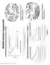 Fig. 18 - Biomarker SPAG5