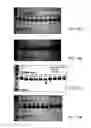 Fig. 16 - Deglycosylation reagents and methods
