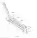 Fig. 17 - FERRULE DEVICE AND METHOD OF MANUFACTURING THE SAME