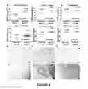 Fig. 09 - Method for determining the risk profile of neoplastic tissue