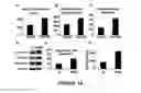 Fig. 14 - Method for determining the risk profile of neoplastic tissue