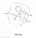Fig. 11 - Systems and methods for providing comprehensive care for stoma patients
