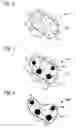 Fig. 05 - Artificial general intelligence system and method for medicine that determines a pre-emergent disease state of a patient based on mapping a topological module