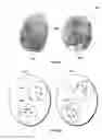 Fig. 11 - Minutiae grouping for distorted fingerprint matching