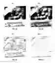 Fig. 05 - Automatic ruler detection