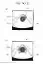 Fig. 15 - SURROUNDING ENVIRONMENT RECOGNITION DEVICE