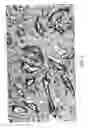 Fig. 05 - Automatic glandular and tubule detection in histological grading of breast cancer