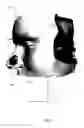 Fig. 08 - Locally applied transparency for a CT image