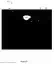 Fig. 08 - X-ray image feature detection and registration systems and methods