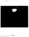 Fig. 09 - X-ray image feature detection and registration systems and methods