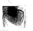Fig. 01 - X-ray image feature detection and registration systems and methods