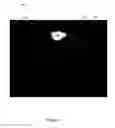 Fig. 08 - X-ray image feature detection and registration systems and methods