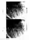 Fig. 22 - X-ray image feature detection and registration systems and methods