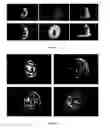 Fig. 02 - Methods for three dimensional reconstruction and determining the quality of an embryo