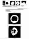 Fig. 04 - Methods for three dimensional reconstruction and determining the quality of an embryo