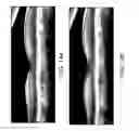 Fig. 14 - Segmentation and identification of layered structures in images