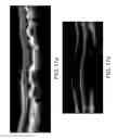 Fig. 17 - Segmentation and identification of layered structures in images