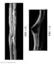 Fig. 18 - Segmentation and identification of layered structures in images