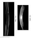 Fig. 19 - Segmentation and identification of layered structures in images