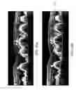 Fig. 24 - Segmentation and identification of layered structures in images