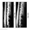 Fig. 26 - Segmentation and identification of layered structures in images