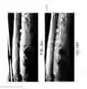Fig. 27 - Segmentation and identification of layered structures in images