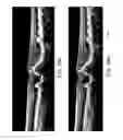 Fig. 31 - Segmentation and identification of layered structures in images