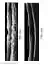 Fig. 35 - Segmentation and identification of layered structures in images