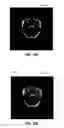 Fig. 27 - Phase transform for object and shape detection in digital images