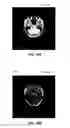 Fig. 30 - Phase transform for object and shape detection in digital images