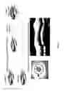 Fig. 24 - Method and apparatus for motion correction and image enhancement for optical coherence tomography