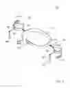 Fig. 03 - Running form aid system